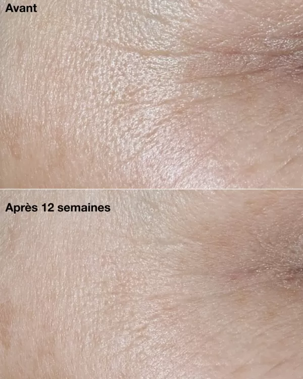 Best Clinique Smart Clinical Repair Anti-Rimpel Corrigerende Creme Spf 30
